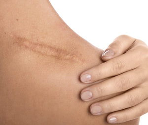 Scarwork & Craniosacral Therapy